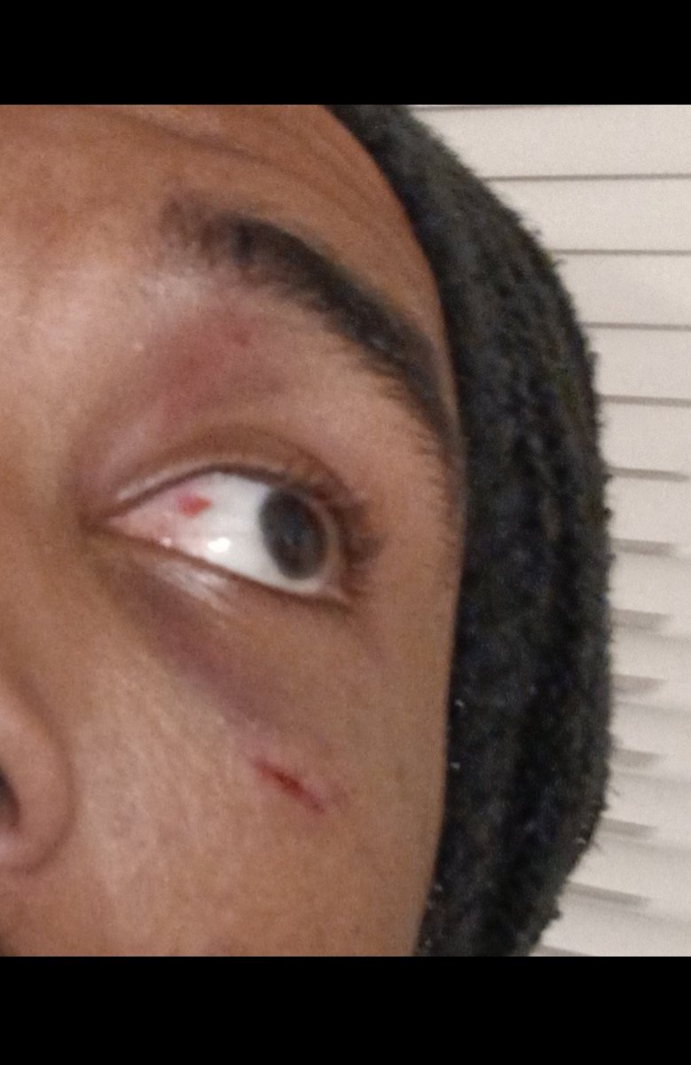 MICHAEL_JUMPP's tweet photo. Today, after 9 months, I'm truly blessed to say that I've finally returned to Pro Wrestling after serious injury! 🙏✨️ I  will do my absolute best. 💪✨️
怪我から戻ってきました ー！🙏✨️  がんばりまーす。💪✨️

#ProWrestling  #プロレス #IamHome #ただいま  #Jumpp https://t.co/4XlK6PAgbN