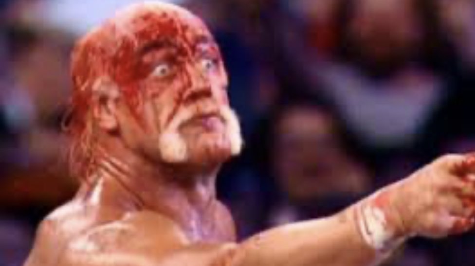OwenBenjamin's tweet photo. That’s what being grazed by a bullet looks like. 
This is trumps “wound”
And here are some photos from a popular tv show in America called world wrestling. https://t.co/VToiL1tfVw