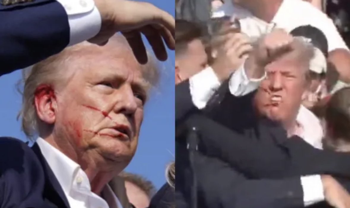 OwenBenjamin's tweet photo. That’s what being grazed by a bullet looks like. 
This is trumps “wound”
And here are some photos from a popular tv show in America called world wrestling. https://t.co/VToiL1tfVw