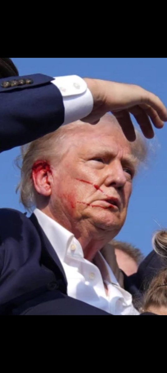 nirbhaysirohi's tweet photo. God just spared President Trumps life!ππ½πΊπΈ
The bullet grazed his ear! Pray for him right now! #Prayfor45 https://t.co/H5QesH0s9i