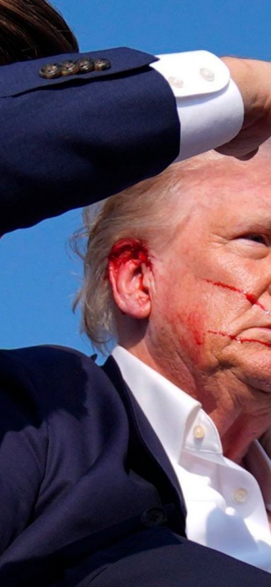MAVERIC68078049's tweet photo. There's no visible wound. There's "blood" but there's no visible wound. 

There's also the strange disconnect between what's on his face and his ear. https://t.co/VvrbmjAvpZ