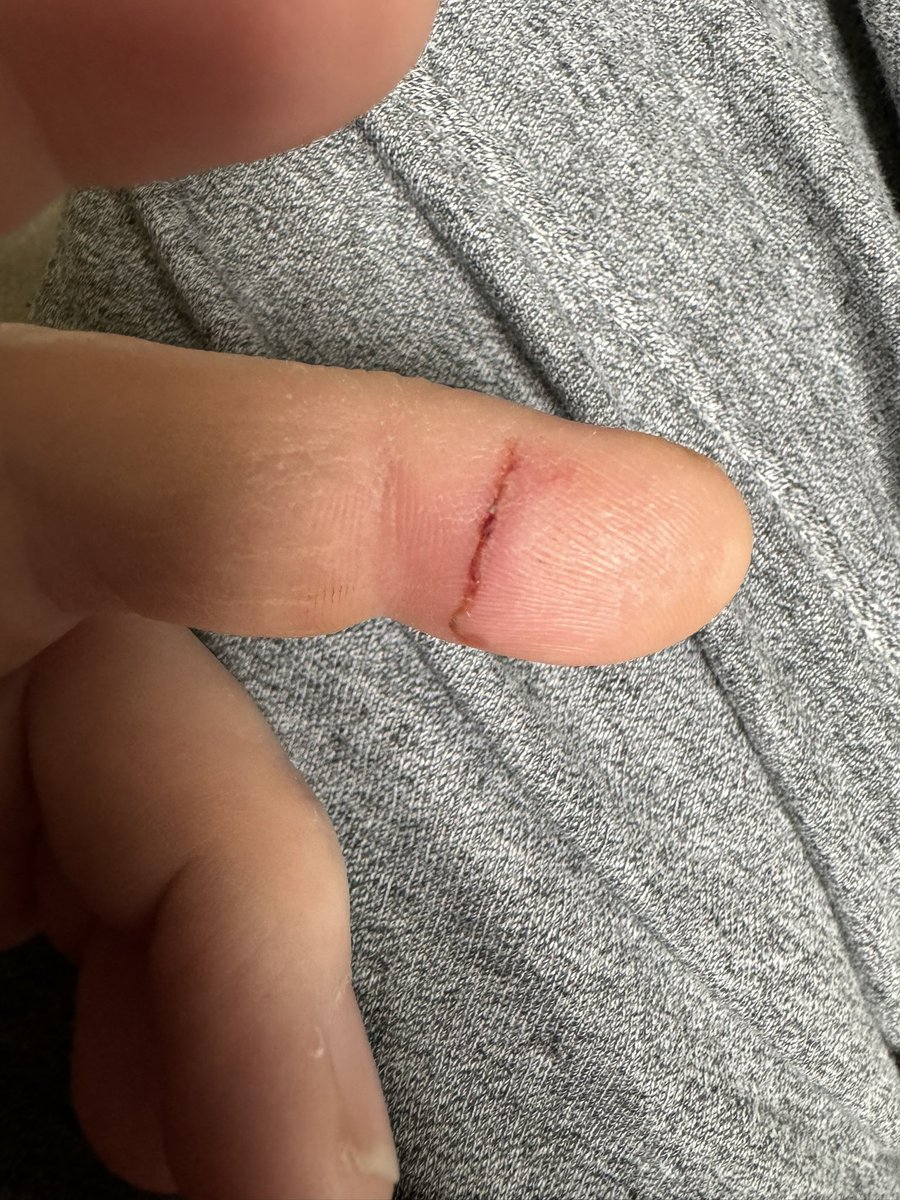 Booked Deadpool and Wolverine tickets for the family last night. Think Wolverine’s powers have been passed on to me. Knitted nicely. Hopefully doesn’t open again tomorrow at work though.