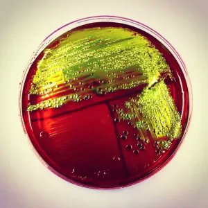 microbeonline's tweet photo. Escherichia coli (E. coli) is a bacterium commonly found in the gut of humans and warm-blooded animals. Most E. coli are normal flora or commensals found in the intestinal tract. It is a gram-negative short rod, a member of the family Enterobacteriaceae. https://t.co/XDgsU5KJ8n