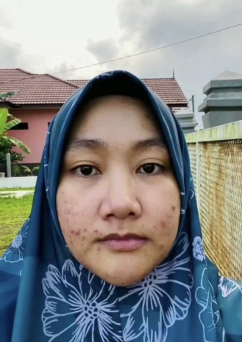 zaffy_co's tweet photo. Benda yang paling membahagiakan adalah jumpa skincare yang berkesan dan sesuai dengan kulit. It takes a long time and lotssss of effort to find something yang really buat kita lega dengan resultnya. https://t.co/nXptQZ5Yuo