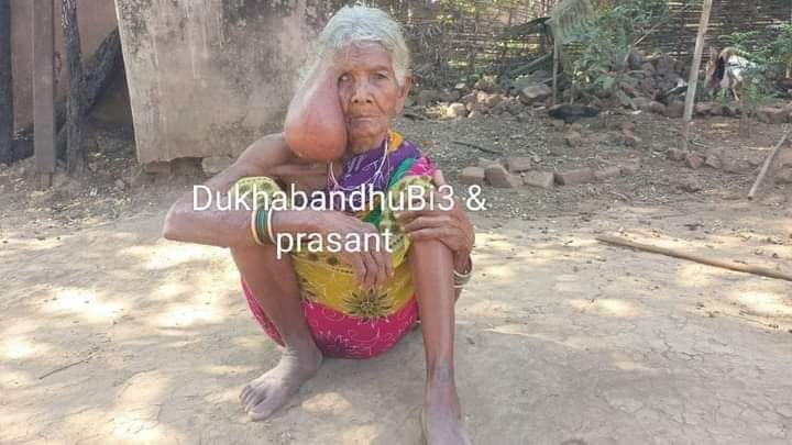 DukhabandhuBi13's tweet photo. ଟାଇମ୍ସ ୱାନ ଓଡ଼ିଆ @timesoneodia20 ଏବଂ HRDFI ର ମହାପ୍ରଭାବ
#ନ୍ୟୁଜ ଏବଂ @DukhabandhuBi13 ଦୁଃଖବନ୍ଧୁ ବିଶ୍ୱାଳଙ୍କ ଟୁଇଟ ଇମେଲ୍ ଚିଠି ଫୋନ ମାଧ୍ୟମରେ ଅବଗତ
#ଚେଇଁ ଉଠିଲା କଳାହାଣ୍ଡି ଜିଲ୍ଲା ପ୍ରଶାସନ
#ଦନାର ମାଝିଙ୍କ ଟ୍ୟୁମରର ସଫଳ ଅସ୍ତ୍ରୋପଚାର
#TimesOneOdia #Hrdfi #ImpactNews #SuccessSurgeryOfDanarMajhi #kalahandinews
@CMO_Odisha @MohanMOdisha
@highlight @followers
@MahalingMukesh
@abinash_oas @HFWOdisha @Naveen_Odisha @Abanikanta_1978 @DmKalahandi @ZPKalahandi @dasraghubar @rabindrakjena @suryabanshibjp @KVSinghDeo1 ବହୁତ ବହୁତ ଧନ୍ୟବାଦ ,ଓଡିଶା ସରକାର ଙ୍କୁ ସ୍ୱାସ୍ଥ୍ୟ ବିଭାଗ ଙ୍କୁ ଏବଂ ସମସ୍ତଙ୍କୁ💐🙏🏼❤️