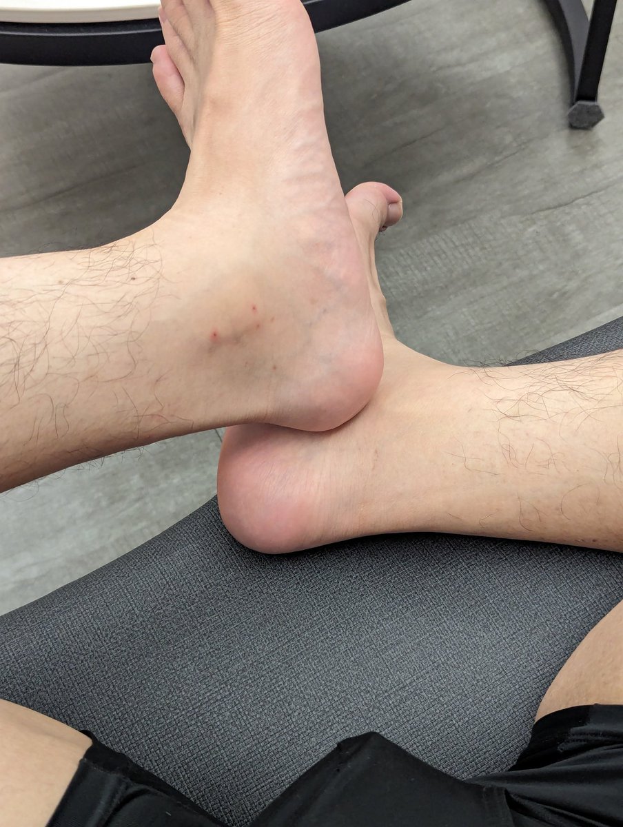 TonyCheng596377's tweet photo. 是蚊子 還是跳蚤🥺 https://t.co/x0Y8ZPrUYS