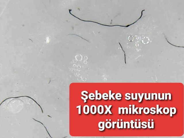 YucelereD's tweet photo. @Ferhatarslandr Evet ama şebeke suyuna ve paketli sulara MIKROSKOPLA bakmayı bir türlü akıl edemeyenler oldukça pek bir şey değişmeyecek. 

Bu maddelerin ne işi var suda ? 
Kanser ve cilt rahatsızlıklarının temelinde bu olabilirmi. 
Bkz. #Morgellon #Fulleren https://t.co/XwpAOhiwRN