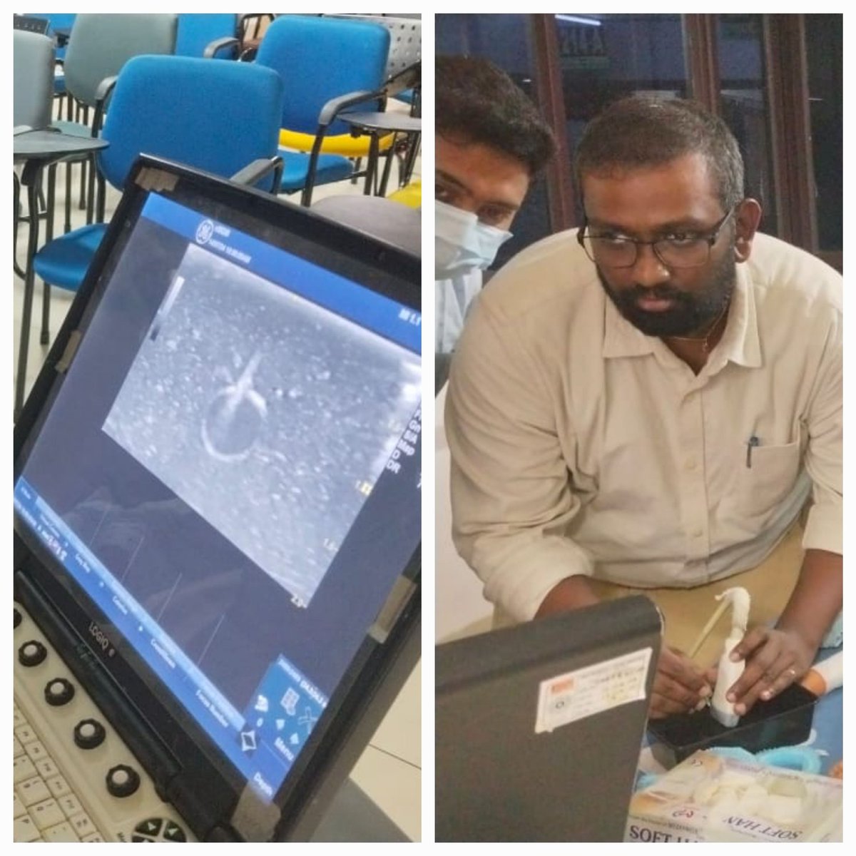 arunkrishnan_b's tweet photo. USG guided central line placement in neonates workshop in mahatma gandhi medical college,Puducherry https://t.co/z7QsG7zFvc