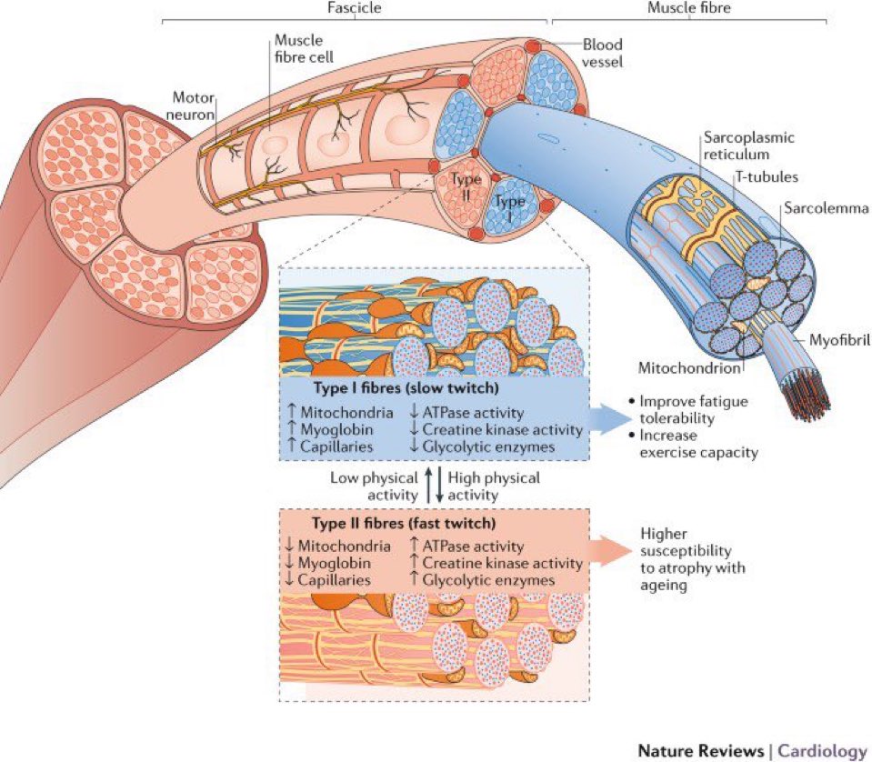 Muscle structure

🔵Type I (slow twitch) fibres👇🏼
⤴️mitochondrial density, myoglobin, capillaries, oxidative capacity, fatigue resistance, exercise capacity

🔴Type II (fast twitch) fibres👇🏼
⤴️ATPase, creatine kinase activity, anaerobic glycolysis

#muscle
nature.com/articles/nrcar…