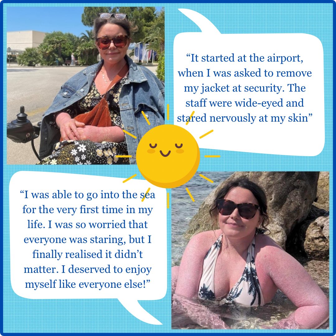 EI_cure_project's tweet image. UK Trustee Rhiannon Morgan recently took a vacation to Croatia. As a person affected with rare skin disease Epidermolytic Ichthyosis, she decided to write about her experiences. 

Read the full story here:
changingfaces.org.uk/story/rhiannon…

#eicureproject #dermatology #ichthyosisawareness