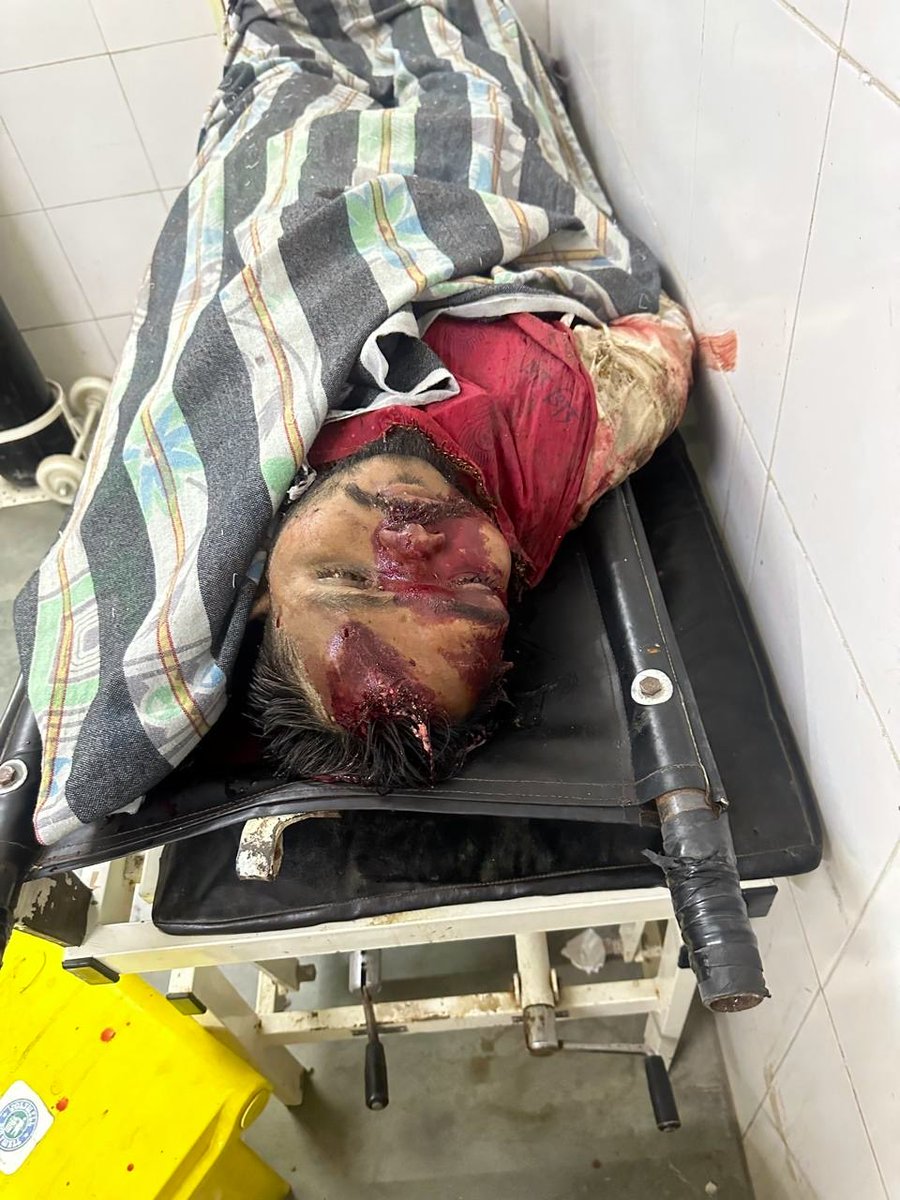 MacTheReaper's tweet photo. Very brutal Hit &amp; Run happened in Pathardi, Ahmadnagar, MH. 
Nitin Pawar (Age 27) died on the spot and his wife Renuka (Age 26) is critically injured, she’s currently having treatment in the Hospital. Deceased Nitin Pawar &amp; Renuka were happily married 5 months ago. https://t.co/ee0EMwvdG1