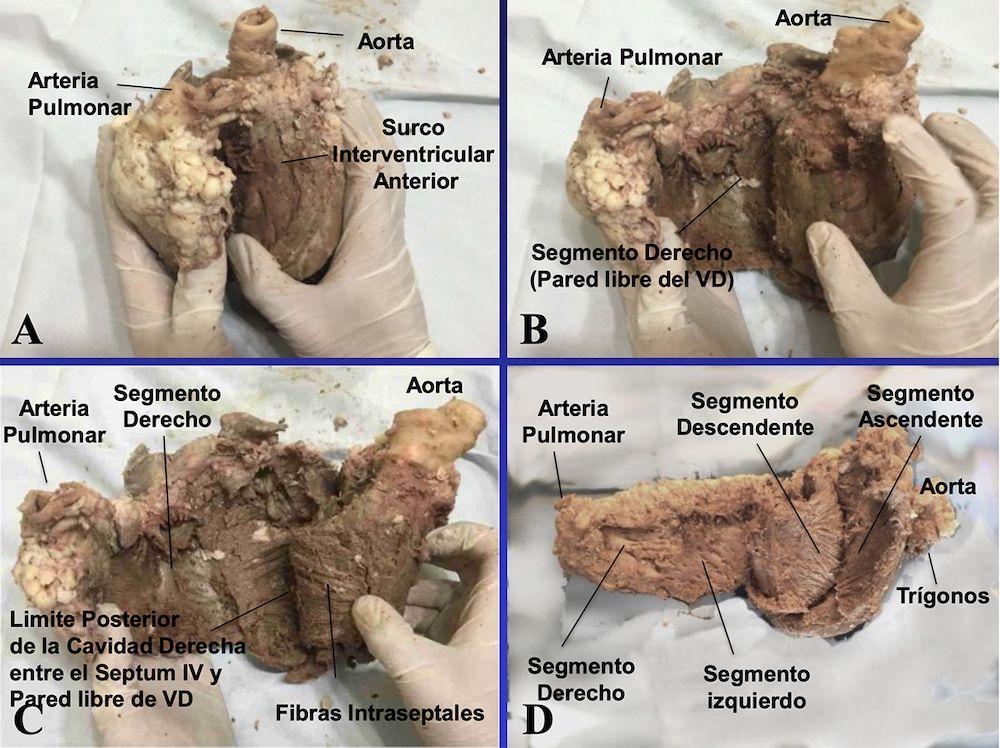 La teoría de la banda miocárdica. Nuevos descubrimientos que apoyan el complejo mecanismo de torsión miocárdica 
📗 buff.ly/3JOasXM ◀️
Repaso de la Revisión publicada en RETICweb