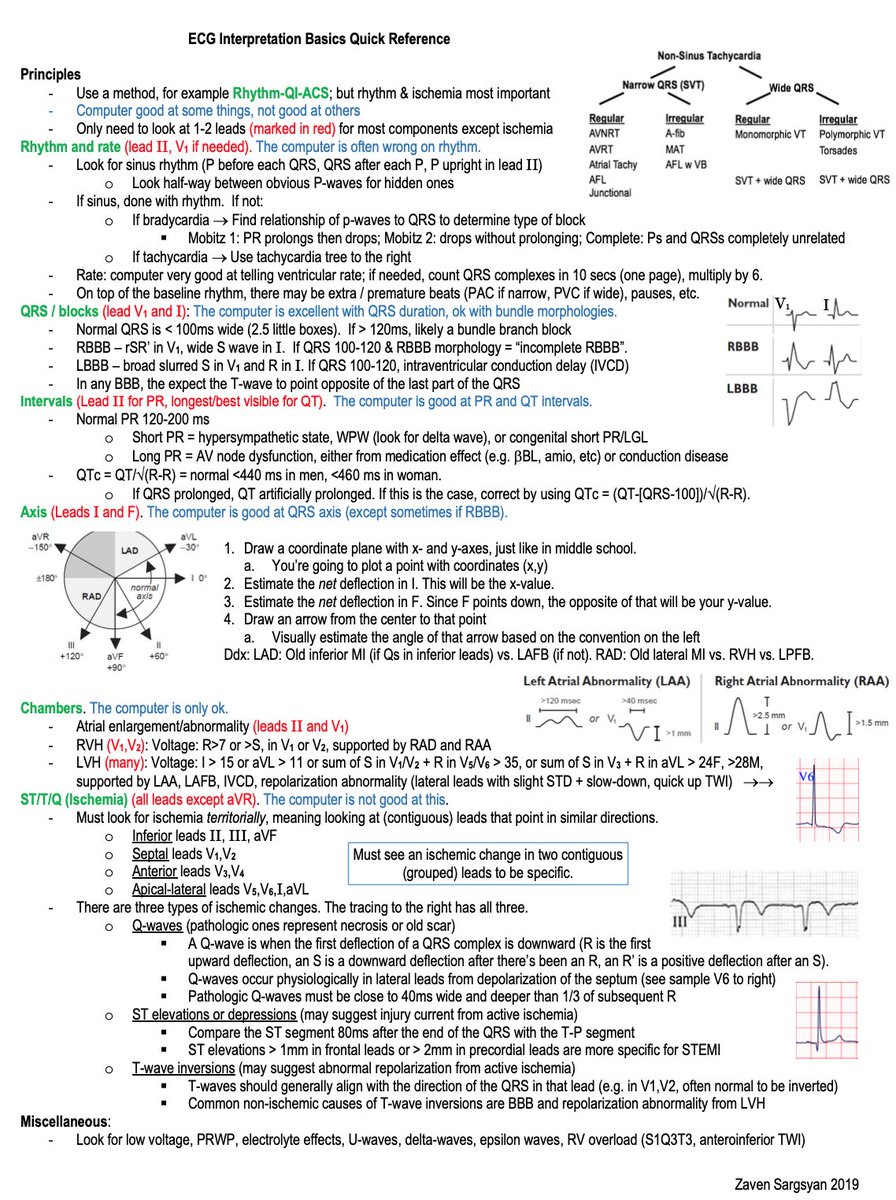 🔴 ECG Interpretation Basics Quick Reference
  🔹 Rhythm and Rate
  🔹 QRS / Blocks
  🔹 Intervals
  🔹 Axis
  🔹 Chambers
  🔹 ST/T/Q (Ischemia)

By Dr. Zaven Sargsyan <a href="/sargsyanz/">Zaven Sargsyan</a>
 #CardioEd #CardioTwitter #medtwitter #cvd #ecg #Medtwitter