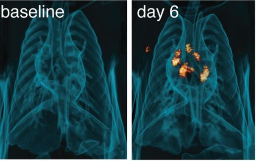 Immunology of Infectious Disease News (@infdisease_news) on Twitter photo Scientists at <a href="/NIAIDNews/">NIAID News</a> examined the roles of the prototypic pro- and anti-🌡️ #inflammatory cytokines IFNγ and IL-10 using the rhesus macaque model of mild #COVID19.
👇 Check out their discovery on the role of IFNγ in lung lesions.
<a href="/PLOSPathogens/">PLOS Pathogens</a> | bit.ly/4f177To Scientists at <a href="/NIAIDNews/">NIAID News</a> examined the roles of the prototypic pro- and anti-🌡️ #inflammatory cytokines IFNγ and IL-10 using the rhesus macaque model of mild #COVID19.
👇 Check out their discovery on the role of IFNγ in lung lesions.
<a href="/PLOSPathogens/">PLOS Pathogens</a> | bit.ly/4f177To