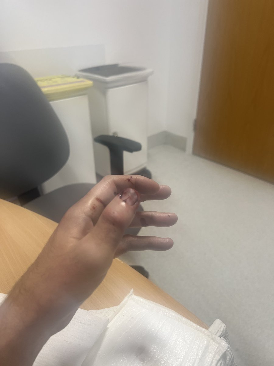 wickofwar83's tweet photo. Wanted male rams police car to evade capture and breaks my hand. Suspect arrested and remanded for court @MPSWForest @MPSRTPC https://t.co/2Rc8EEu31h