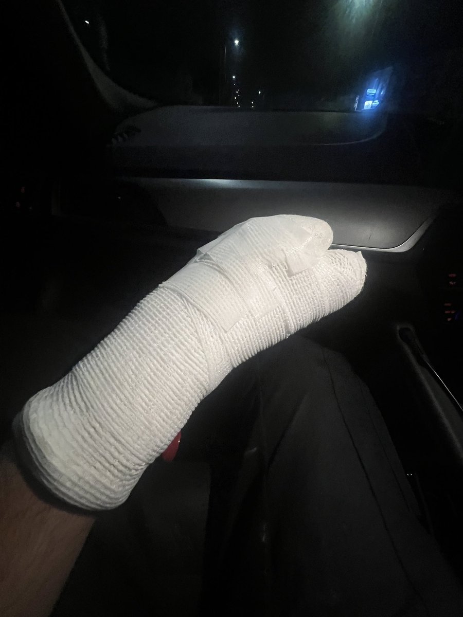 wickofwar83's tweet photo. Wanted male rams police car to evade capture and breaks my hand. Suspect arrested and remanded for court @MPSWForest @MPSRTPC https://t.co/2Rc8EEu31h