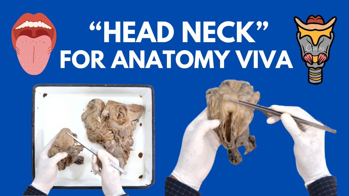 AnatomyDecoded's tweet photo. Watch here👇
https://t.co/0iU9GcvORd https://t.co/9duvHVyLua