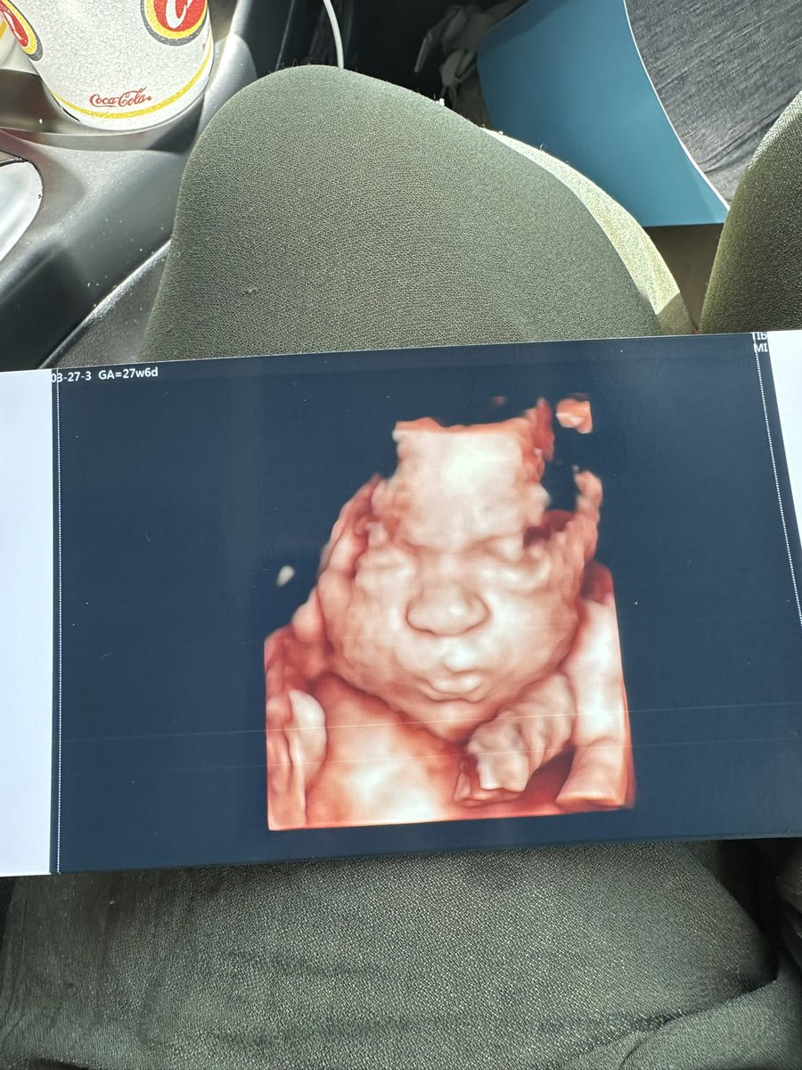 ickiivikki44's tweet photo. @pulte I have been faithfully reposting and having faith in god you’ll notice me! It would be life changing for my baby and I of if I received the 1,000. I haven’t gotten my baby anything yet due to my funds. I’m 8 months pregnant. And it would truly help us 🙏🏼$vamzilla911 https://t.co/BYgnMXvJ7W