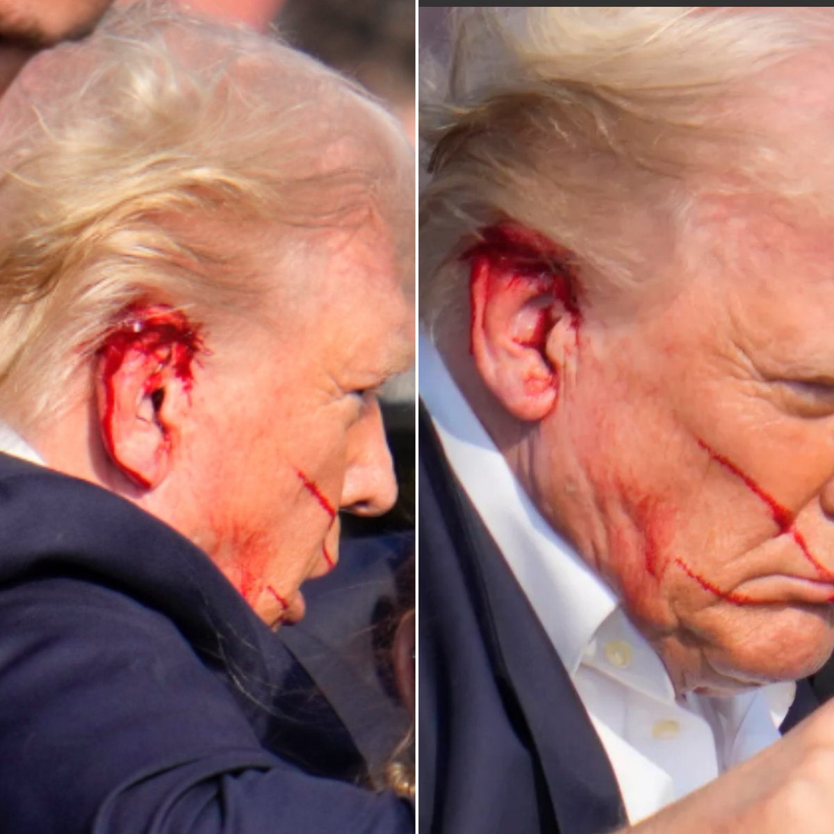NEW JUST IN: It was reported that during a shooting at a rally in Pennsylvania, Donald Trump was struck by glass shards, not a bullet.

No blood spatter on blonde hair or white shirt collar.
