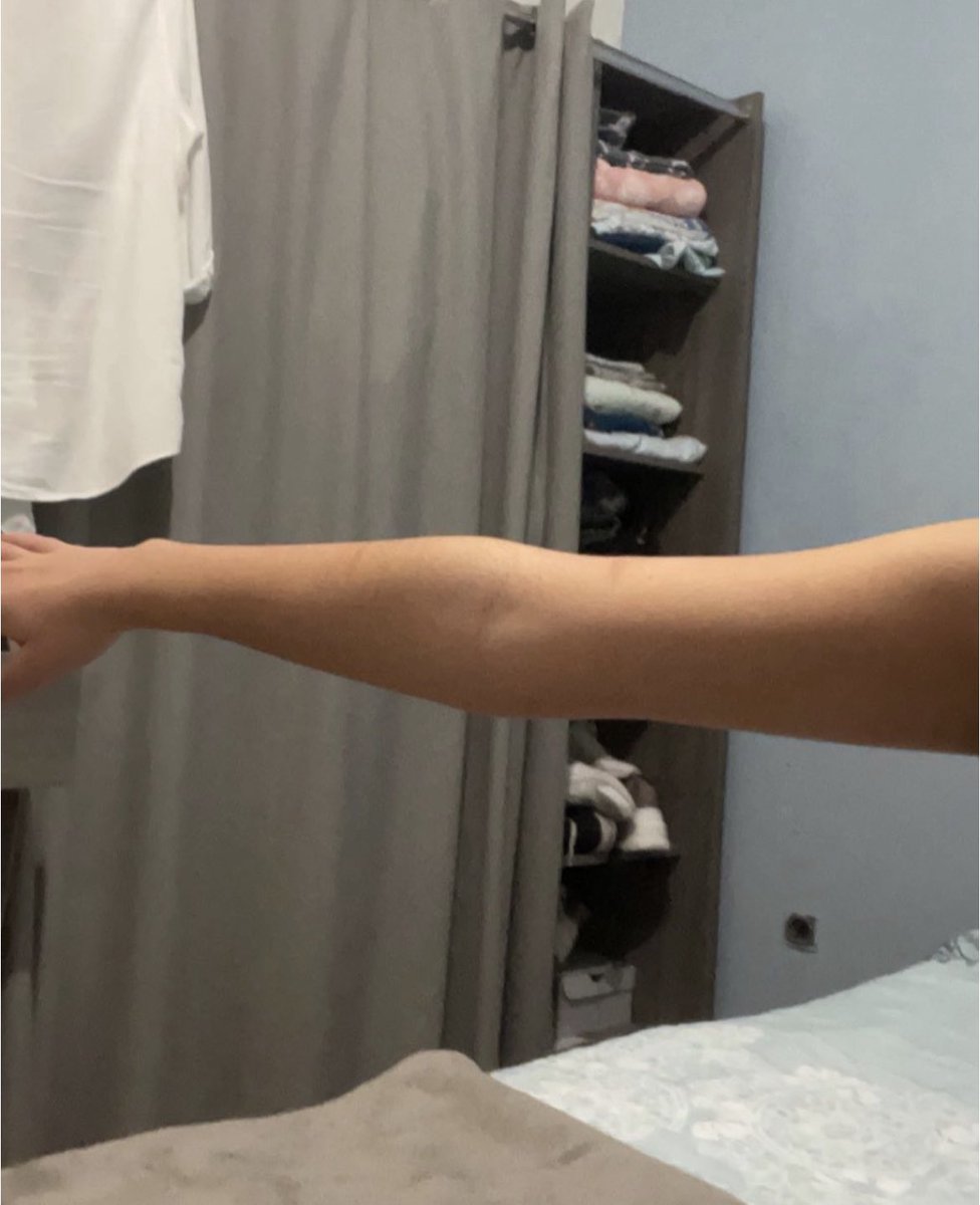 Nana arm reveal because I want to, don’t ask the weight difference between this pic and now