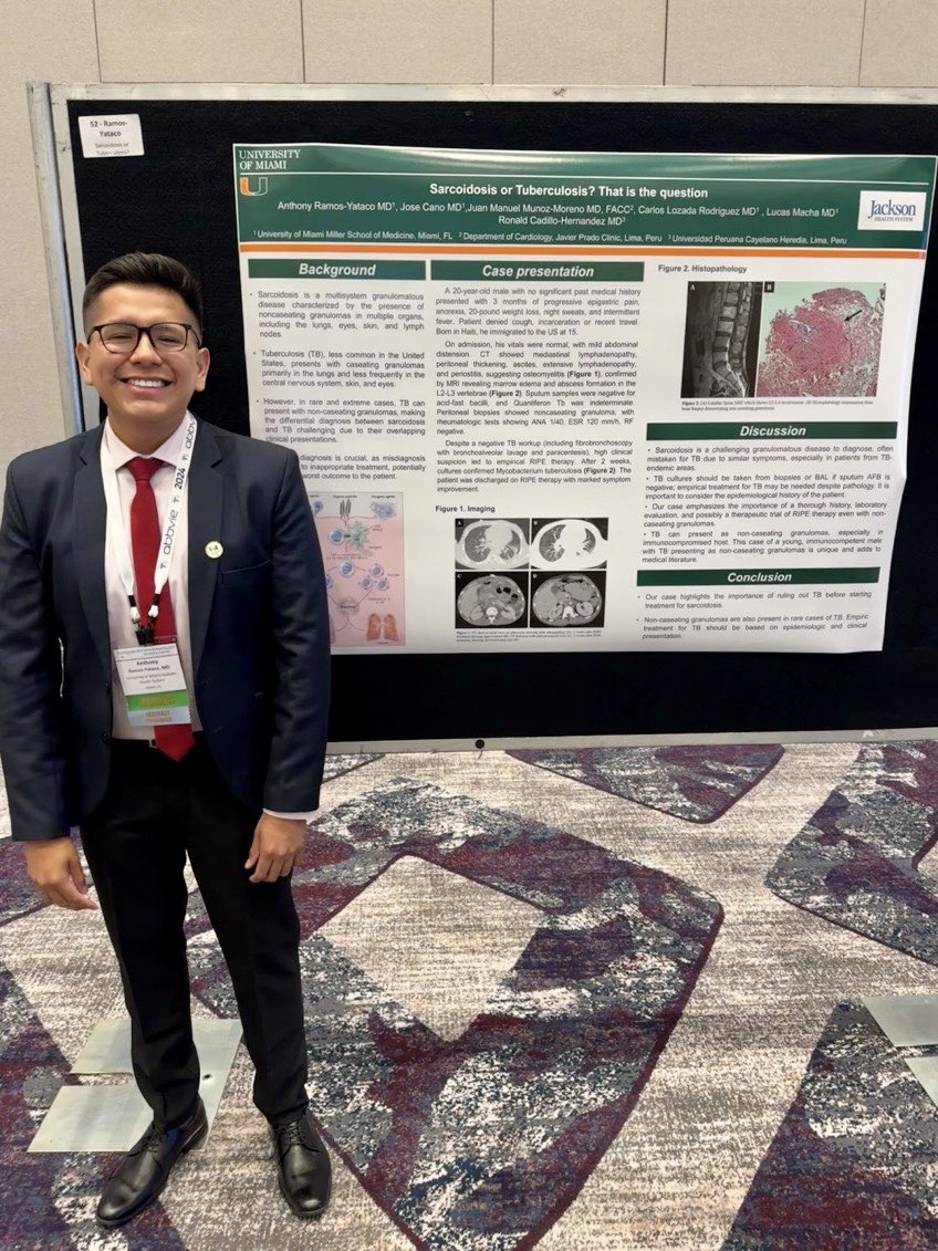 anth_ramosMD's tweet photo. Florida Rheumatology Society 😎😎 
Bilateral knee arthritis related to pembrolizumab 
Sarcoidosis or Tuberculosis ? That’s the question 
#rheumatology @AAPPHealth @UmJmhIMRes https://t.co/y8SDhuPePa