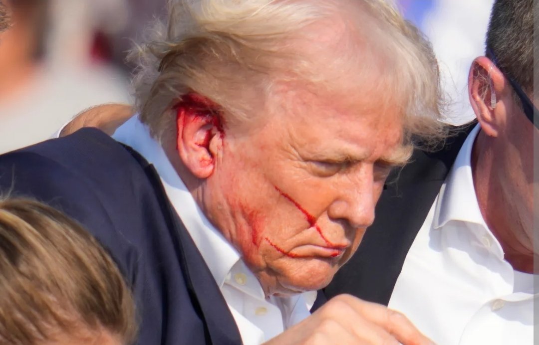 Vindictive71's tweet photo. @YaddaBada123 @Gwensday3 @CryptoRugrats @clownworld That's what everyone said and even showed pictures left to right. But the picture they showed up close the blood trail "splatter" shows from behind him. If the bullet went front to back, there wouldn't be those 2 blood lines.... https://t.co/9B14P2Xbsd