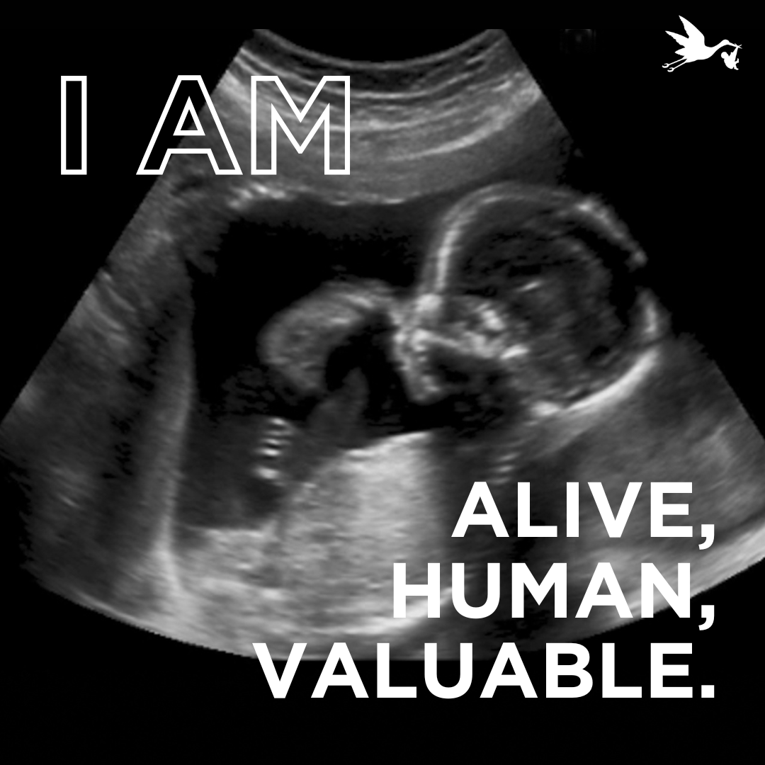 savethestorks's tweet photo. This child is alive, human, and invaluable. They deserve our unwavering protection. #ValueEveryLife #justice #life #empowermoms https://t.co/ddjMEWVY9H