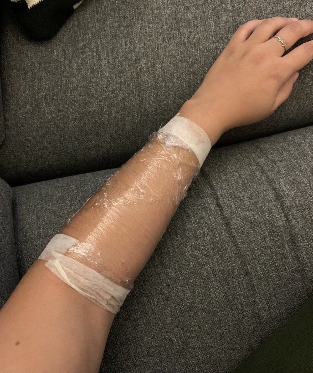 Pampa139's tweet photo. El fanatismo de los libertarios no tiene límites. Este se tatuó todas las medidas que Milei implementó para favorecer a la clase trabajadora. Están locos. https://t.co/SP4cFbLn7X