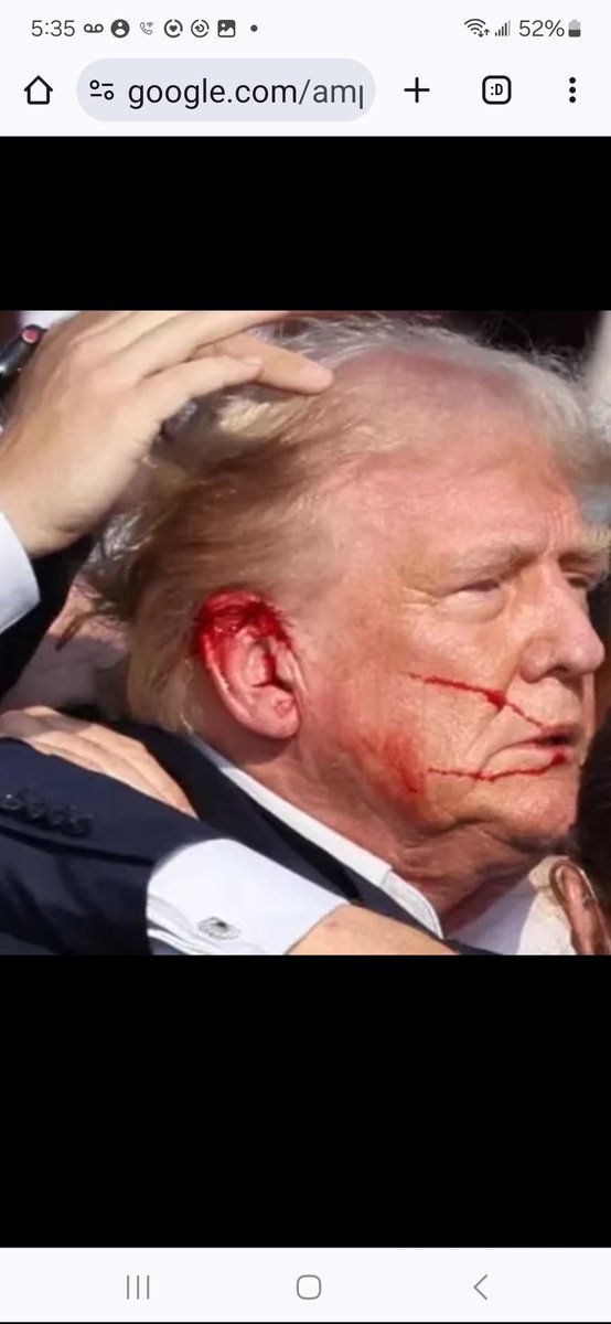 TbeCproject's tweet photo. #laOrejadeTrump 1. Le dispararon con un rifle de alto calibre y no le volò un pedaso. 2. Ninguna càmara captò el disparo. 3. No sangrò hasta que Trump le puso la mano. 4. El asesino estaba en el techo y la gente lo fografio y postearon fotos, pero el SS no sabia. 5. El SS no lo cubriò al sacarlo, como si supieran que ya no habria otros asesinos.