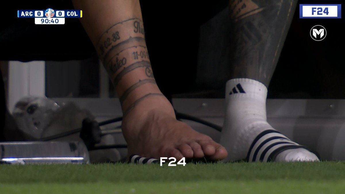 fendii_30's tweet photo. Messi’s ankle is literally a balloon WTFFFF https://t.co/WtbgnDNjOg