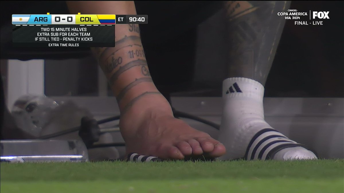 NFL_DovKleiman's tweet photo. Messi's ankle 😳 https://t.co/lOvKQROOaS