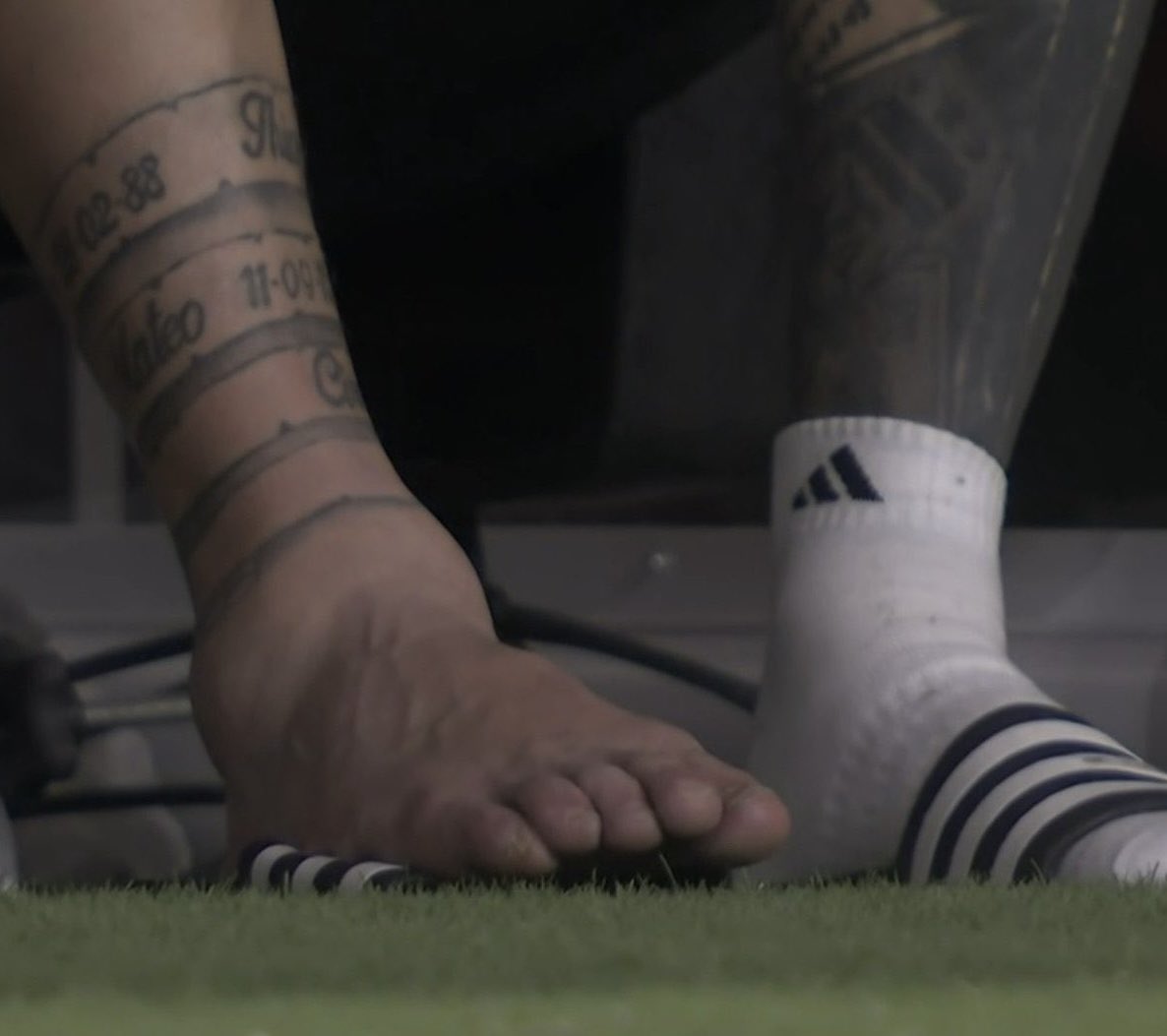 InvictosSomos's tweet photo. El tobillo de Lionel Messi. TREMENDO. https://t.co/bj1OiwG3jj