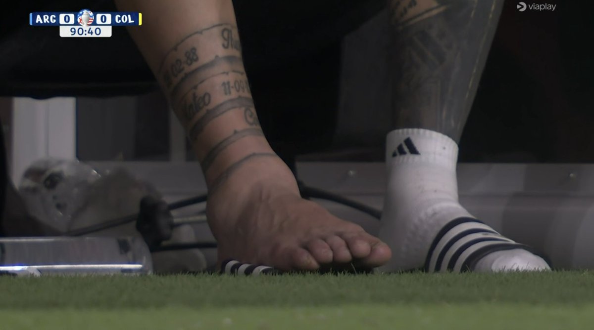 Rhevolver's tweet photo. Jajajaja vete a la verga el tobillo del Messi está más hinchado que culo de acapulqueña 🤣 https://t.co/JpDS3ERhg5