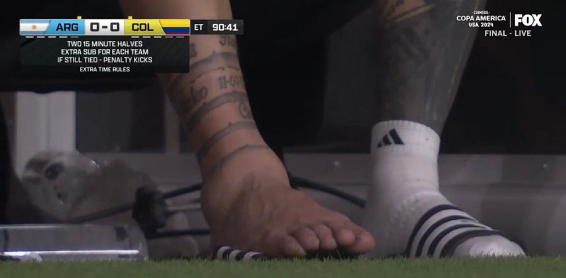 It’s incredible Messi is even walking. What a warrior