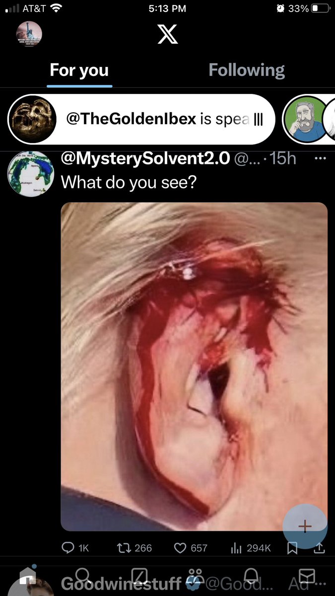 dmca1dkr8r's tweet photo. @BlackKnight10k Never forget: Trump was hit by glass or else the booboo on his ear would be a giant hole in the side of his face. Exposed himself over &amp; over again! Was worried about his shoe! Stopped to get photo ops &amp; yelled Fight while his SS stopped &amp; smiled for the cameras! Very weird https://t.co/s0DtaAANx5