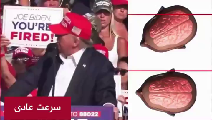 gorbehnare's tweet photo. به اذن خدا، ترامپ لحظه‌ی آخر ۴۵ درجه صورتش رو به سمت راست افراطی چرخوند تیر از کنار مغزش رد شد

(عکس دزدیده شده از شبکه‌ی خوب منوتو) https://t.co/5bNnWe72kK