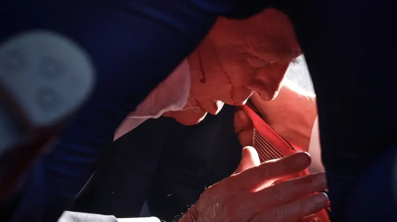 COMO NO CASO DA  FAKEADA DE BOLSONARO , NO CASO DE TRUMP , ELE LEVOU UMA MORDIDA DE UM DE SEUS SEGURANÇAS. SE FOSSE UM TIRO MESMO , TERIA PERFURADO A ORELHA E SE ALOJADO NO CRÂNIO, FATAL , CAIXÃO MESMO.