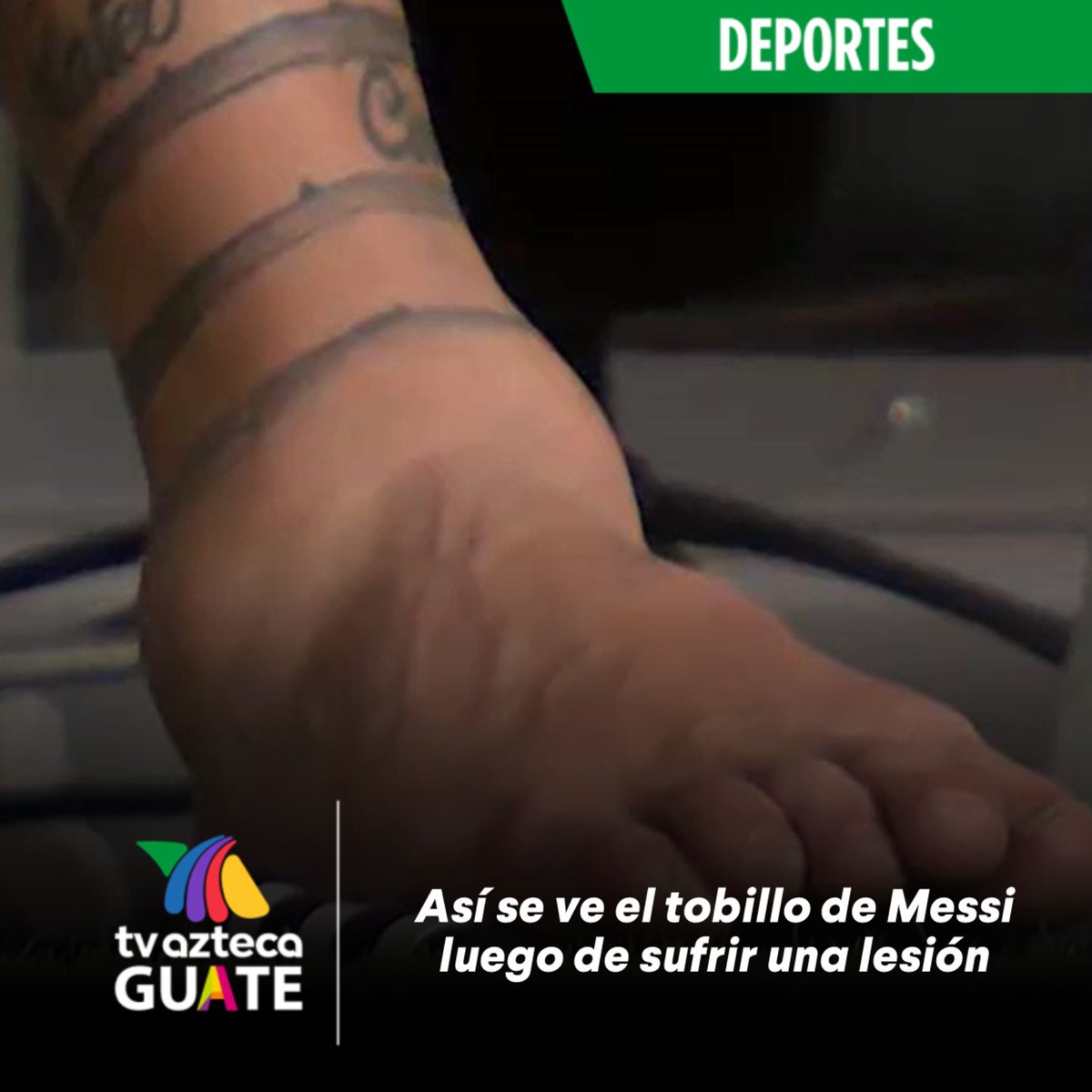 AztecaGuate's tweet photo. #Impactante | 😳 Así se ve el tobillo de Messi luego de sufrir una lesión en la final de la #ConmebolCopaAmerica https://t.co/O0cgXLRKPX