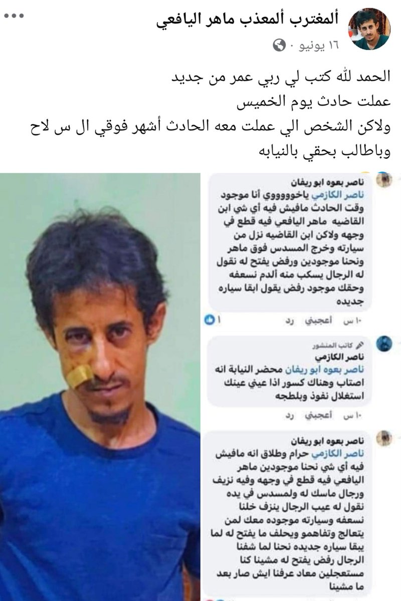 nafea_2020's tweet photo. الرأي العام يطالب بغضب وبصوت واحد حيادية القضاء وسجن الطرف الثاني ابن القاضية صباح العلواني على اشهار سلاحه وتهديده ضد المسجون #ماهر_اليافعي أثناء الحادث وهو ينزف دماً ورفضه للمتواجدين إسعافه في قضية الشروع في القتل.
القضية بين طرفين وليست ماهر فقط والشهود على استعداد لادلاء شهادتهم