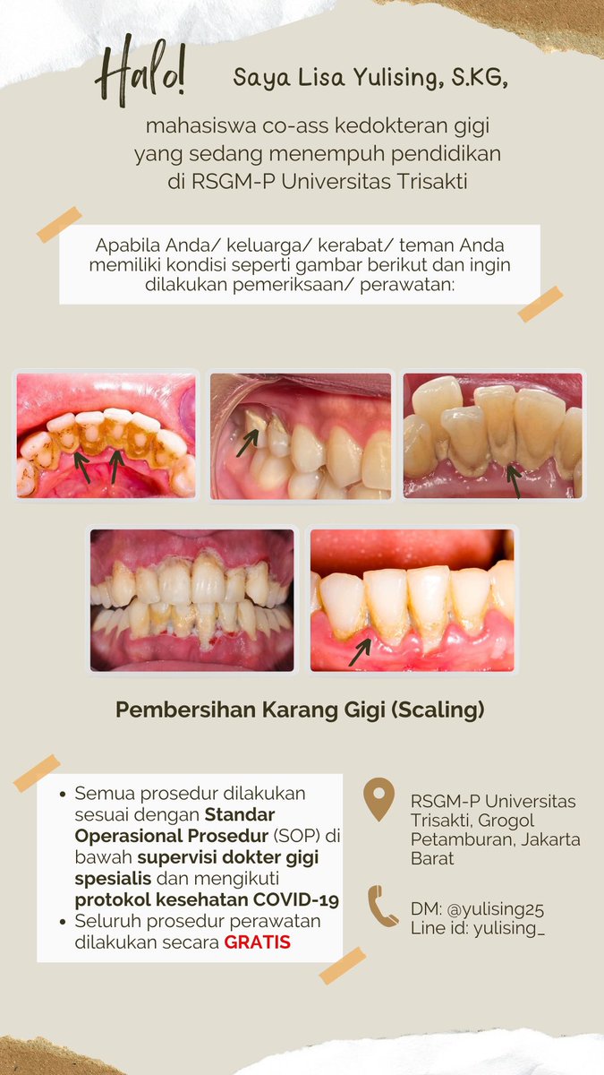 yulising25's tweet photo. Hallo, apabila ada yang memiliki keluhan karang gigi yang menumpuk dan mau dirawat boleh dm aja yaa untuk dibantu perawatannya terima kasih😊 #scaling #karanggigi #perawatangigi #sakitgigi #gusiberdarah #skeling #gigi #doktergigi #koasgigi #koas https://t.co/m99zseEm9y