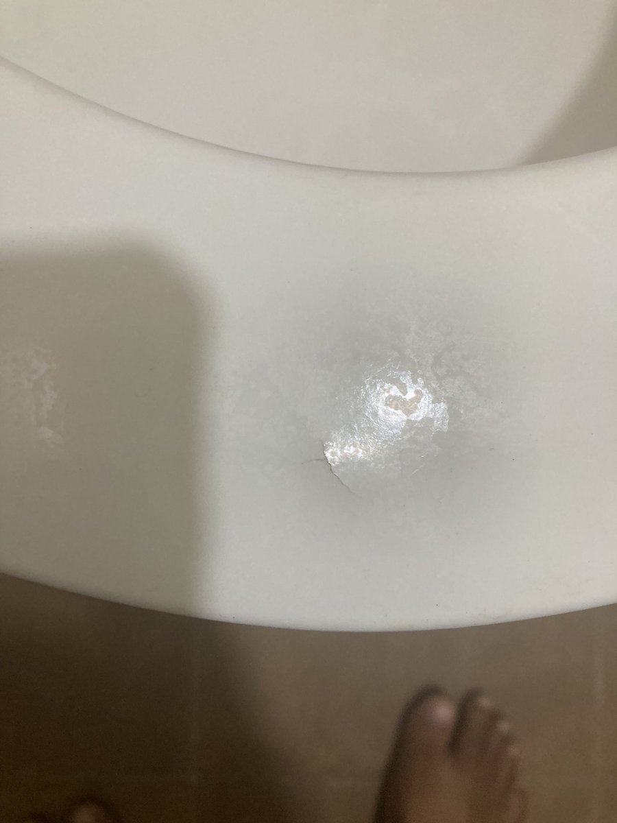 krisathish's tweet photo. @JaquarGroup am sathish from Chennai. Recently I built a new house. I bought all the products from Jaquar. With in 3 month toilet seat cover start pealing. I raised 2 case, but the closed the ticket without my knowledge. Even am not shared the satisfaction code.Very worst service https://t.co/72J8Y7PGp7