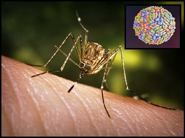 emergencyres's tweet photo. West Nile virus is a viral infection carried by mosquitoes. It belongs to a group of viruses called flaviviruses. A person infected with the virus may have no symptoms.
Visit us: https://t.co/ar7XoKqsDG
#nile #virus #infection #muscles #inflammation #brain #encephalitis #flu https://t.co/fmnhCFrllA