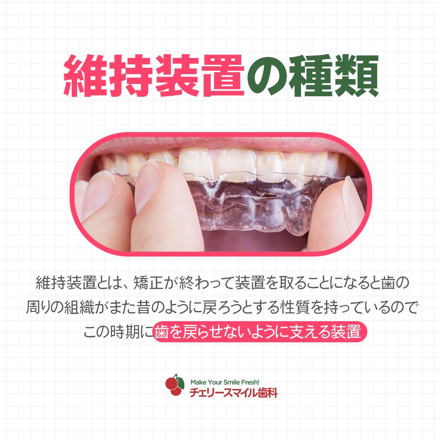 矯正が終わったからとすぐ装置を外すのではなく、 維持装置を付ける