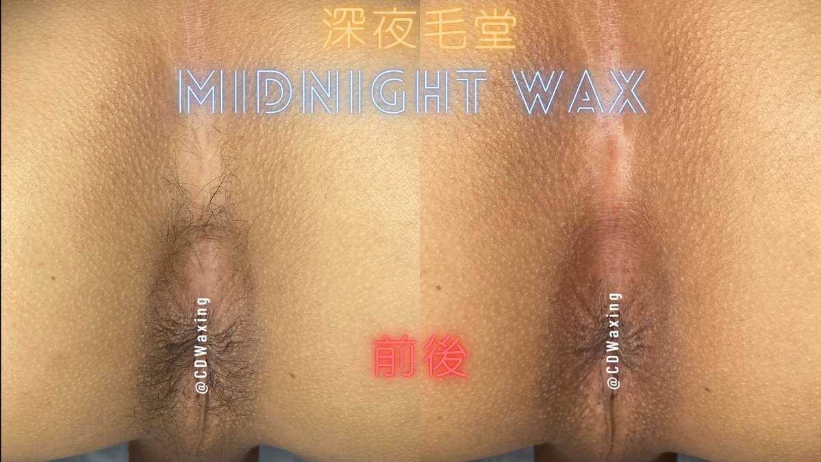 CDWaxing's tweet photo. 住湖口的小哥哥來除毛��🏼‍🍳

餐廳內場真的工作環境悶熱🤬
建議可以找隔天放假來除毛會更好照顧喔！

#桃園 #熱蠟除毛 #深夜毛堂 #男仕熱蠟除毛 #偽娘 #獨立工作室 #私密部除毛 #除毛作品 https://t.co/CO1RKscYqh