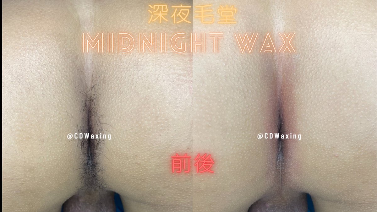 CDWaxing's tweet photo. 住林口小哥哥來除毛😌

也是熟客了
每次分享的故事都很有趣��

#桃園 #熱蠟除毛 #深夜毛堂 #男仕熱蠟除毛 #偽娘 #獨立工作室 #私密部除毛 #除毛作品 https://t.co/TrBMUOf3mk
