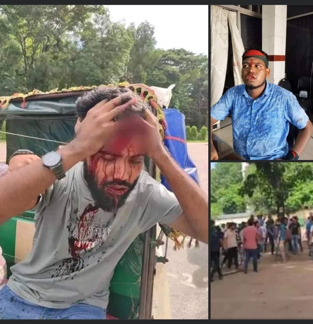 TheProtesterBD's tweet image. Bangladesh Chhatra League's students have beaten DU students for quota movement, even the female students have been beaten.

Some brutal images from today. More pictures in the comment.

#Bangladesh #QuotaMovement #Quotamovement2024 #DhakaUniversity