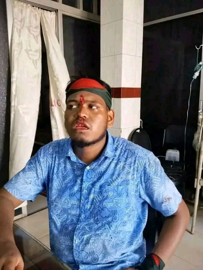 haquemi_'s tweet photo. #saveBangladesh #QuotaMovement #QuotaReformProtest #Quotamovement2024 #Bangladesh #StudentProtest
#attackonstudent https://t.co/t4vPepDc8v