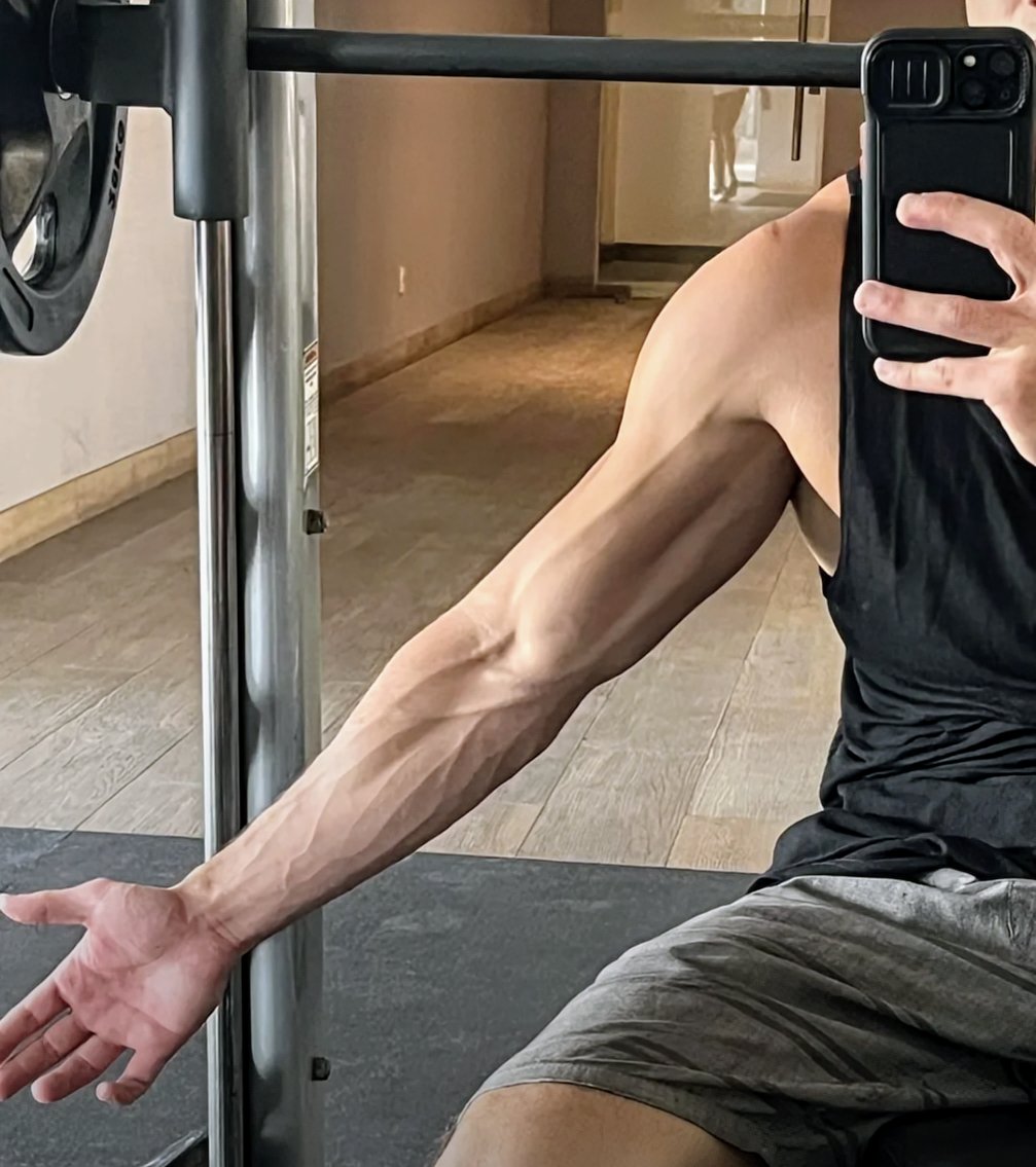 92mighty92's tweet photo. Appreciate some forearms with me!
#Forearms #veins #arms #muscle #vascular #flexing #stronggrip #bighands #bigarms #bowlingpins #bigarm #bigarms #forearm https://t.co/k6qz9GLTyl