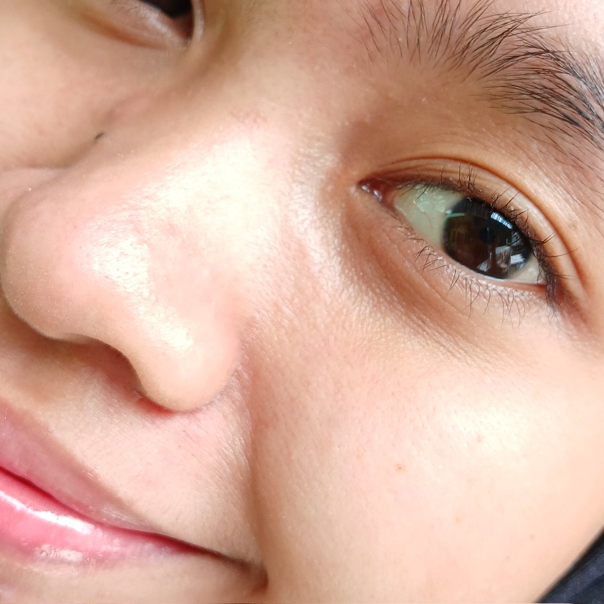 s0ftgurll's tweet image. STOP PAKE EXFOLIASI kalau kalian masih salah cara pakainya 🙅♀️‼️
Ini dia hal-hal yang perlu diperhatiin kalau kalian pake peeling serum, hasilnya bisa maksimal kalau cara pakainya bener. Pori-pori auto mulusss bangettt ✨️