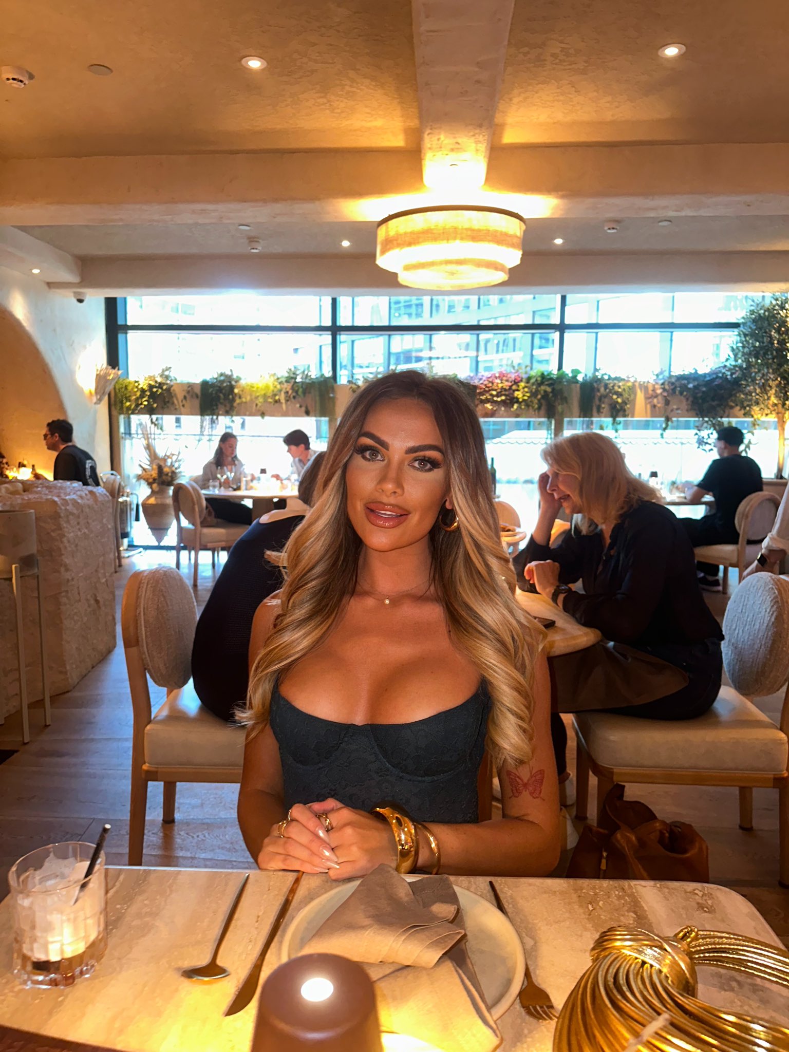Why Amy from MAFS UK Chose Face Surgery After Trolling